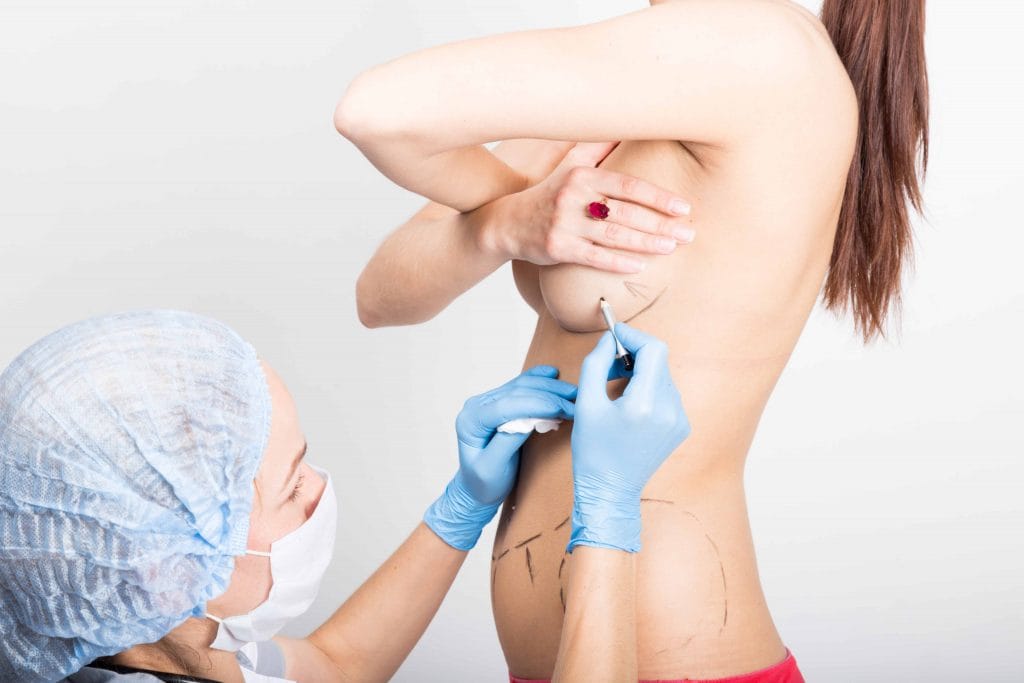 Tubuläre Brust – Brustchirurgie in Bochum: Ihre Experten für Körperformung