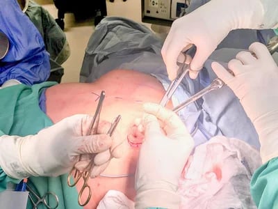 Tubuläre Brust – Brustchirurgie in Bochum: Ihre Experten für Körperformung