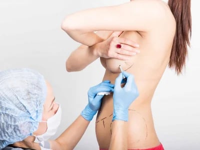 Tubuläre Brust – Brustchirurgie in Bochum: Ihre Experten für Körperformung