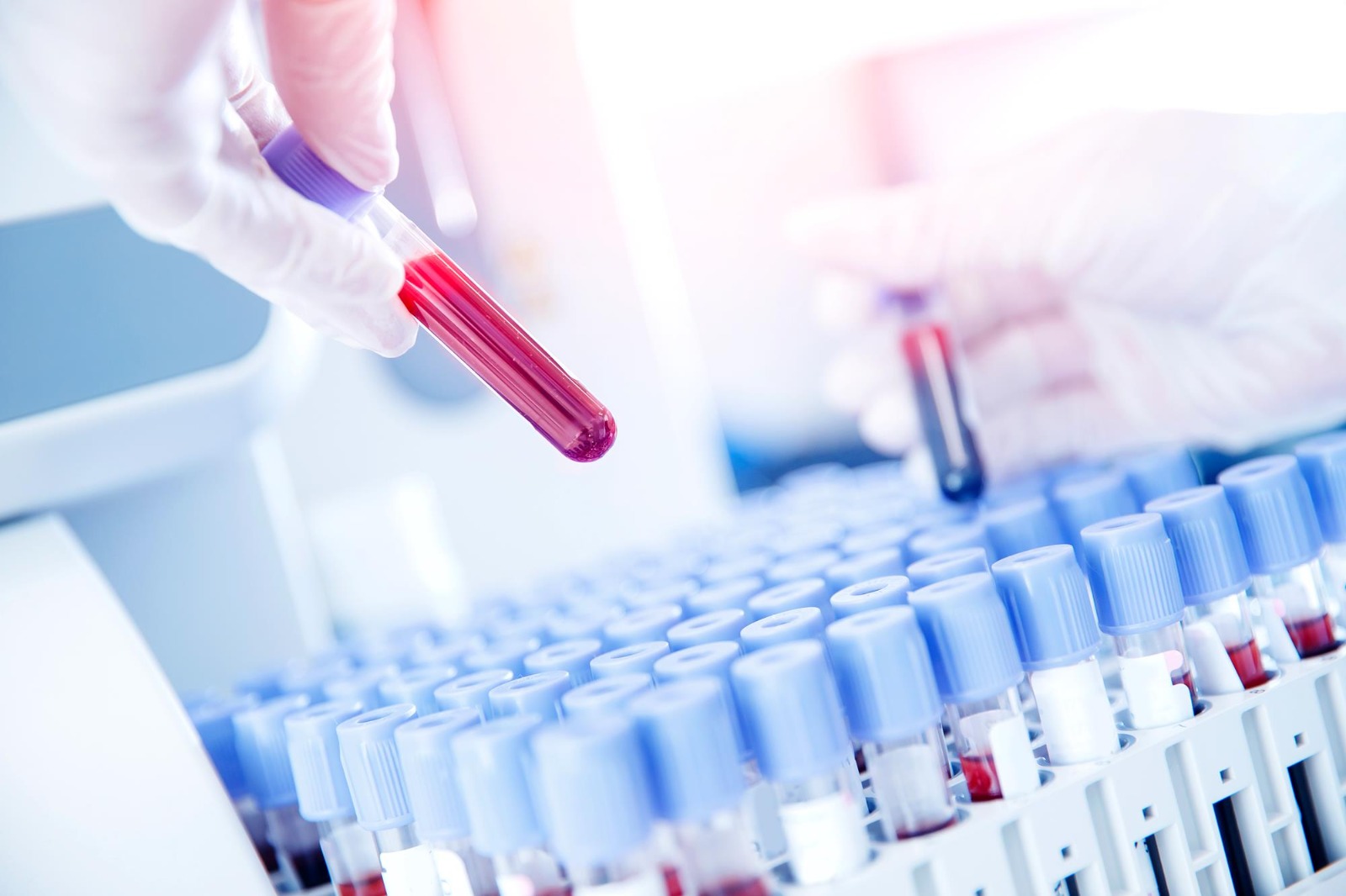 LIMS: Reduzierung von Fehlerquellen durch automatisierte Prozesse