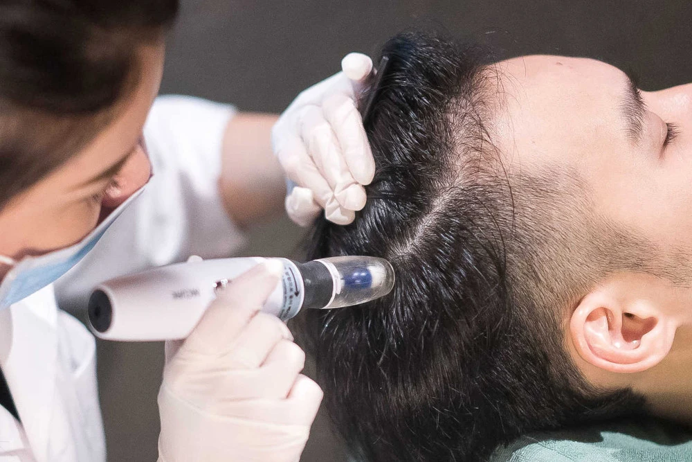 Haarwachstum fördern mit meso hair – jetzt verfügbar